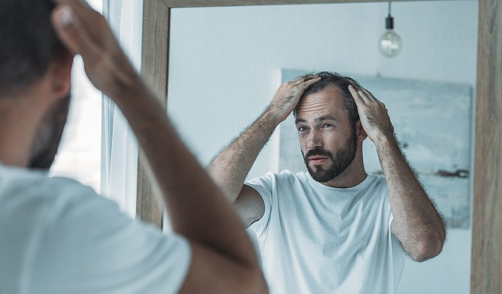 What Are The Best Supplements For Hair Loss?